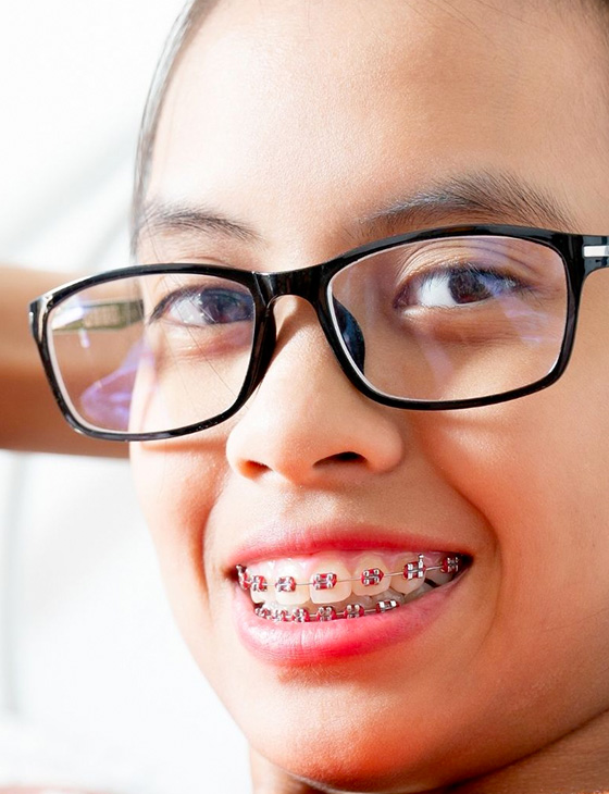 img-treatment-braces