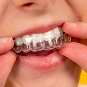 thumb-treatment-braces-clear